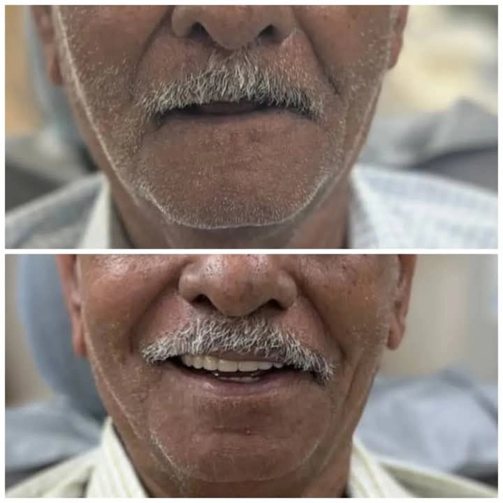 Dental treatment cost