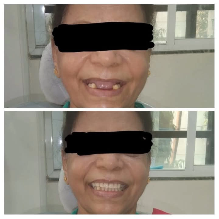 Dental treatment cost