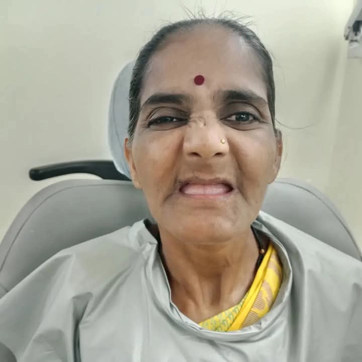 before-after31 Dental treatment cost