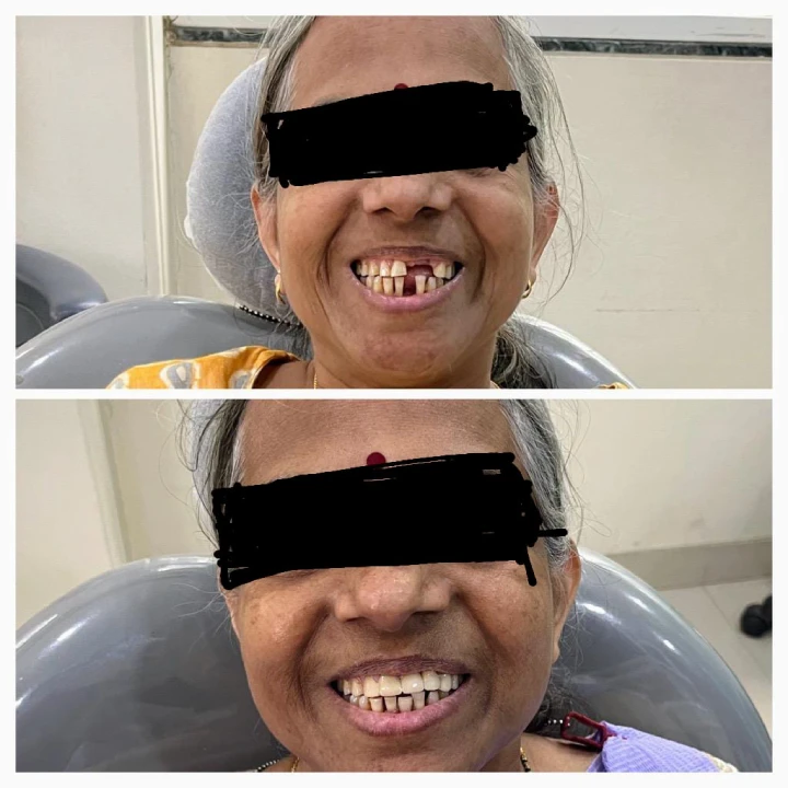 Dental treatment cost