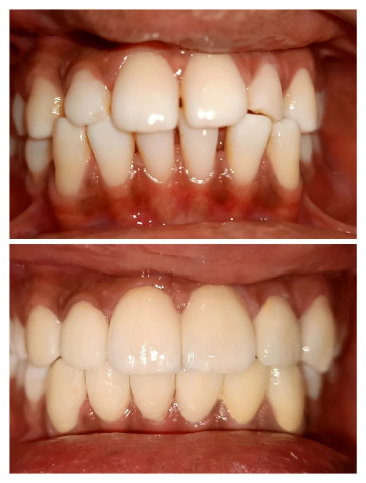 Dental treatment cost