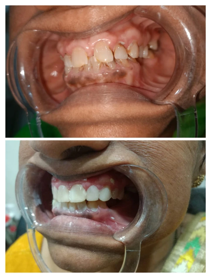 Dental treatment cost